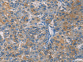 ZBTB1 Polyclonal Antibody – Figure 1 of 3