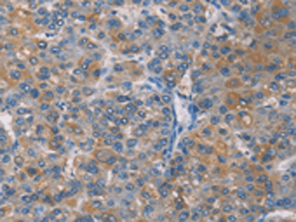 ZBTB1 Polyclonal Antibody – Figure 1 of 3