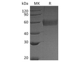 Recombinant Vaccinia virus Soluble Interferon α/β Receptor B18 Protein (His Tag) – Figure 1 of 2
