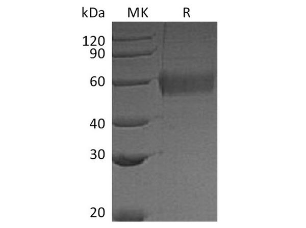 Recombinant Vaccinia virus Soluble Interferon α/β Receptor B18 Protein (His Tag) – Figure 1 of 2