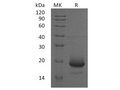 Recombinant Human Interleukin-4/IL-4 Protein (His Tag) – Figure 1 of 3
