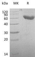 Recombinant Mouse CD28/TP44 Protein (Fc & His Tag) – Figure 1 of 2