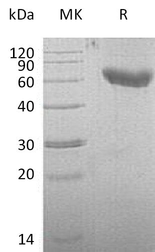 Recombinant Mouse CD28/TP44 Protein (Fc & His Tag) – Figure 1 of 2