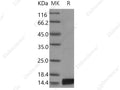 Recombinant Mouse Interleukin-17/IL-17 Protein - Figure 1 of 2