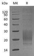 Recombinant Mouse ICOS/AILIM Protein (His Tag) – Figure 1 of 2
