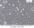 Immortalized Normal Human Intrahepatic Biliary Epithelial Cells (NhIBE) - SV40T+hTERT | Applied Biological Materials (abm)