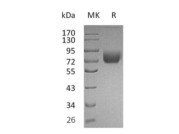 Recombinant Mouse IFNGR1 Protein (Fc Tag) – Figure 1 of 2