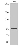 Phospho-CHEK2 (Thr68) Polyclonal Antibody – Figure 1 of 4