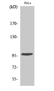 Phospho-CHEK2 (Thr68) Polyclonal Antibody – Figure 1 of 4
