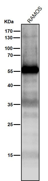 All lanes use the Antibody at 1:1K dilution for 1 hour at room temperature.