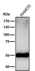 All lanes use the Antibody at 1:2K dilution for 1 hour at room temperature.