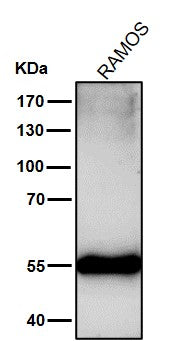 All lanes use the Antibody at 1:2K dilution for 1 hour at room temperature.
