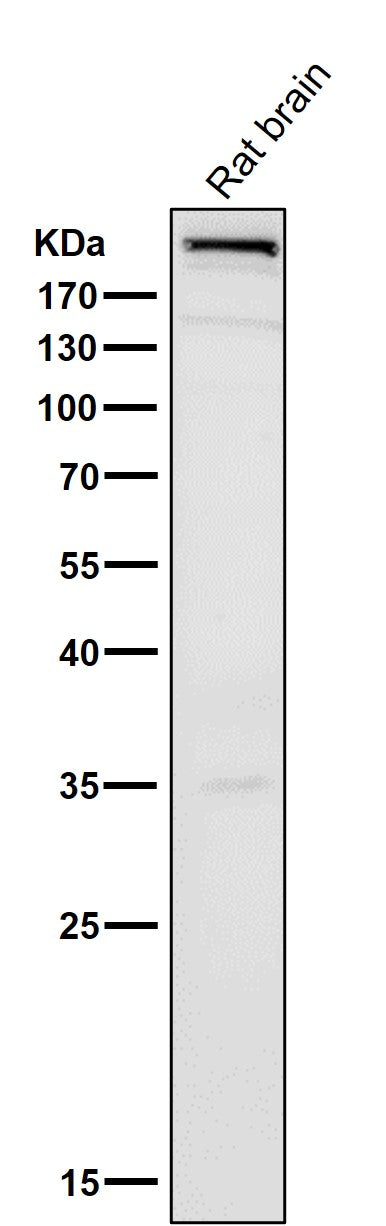 All lanes use the Antibody at 1:500 dilution for 1 hour at room temperature.