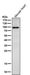 All lanes use the Antibody at 1:1K dilution for 1 hour at room temperature.