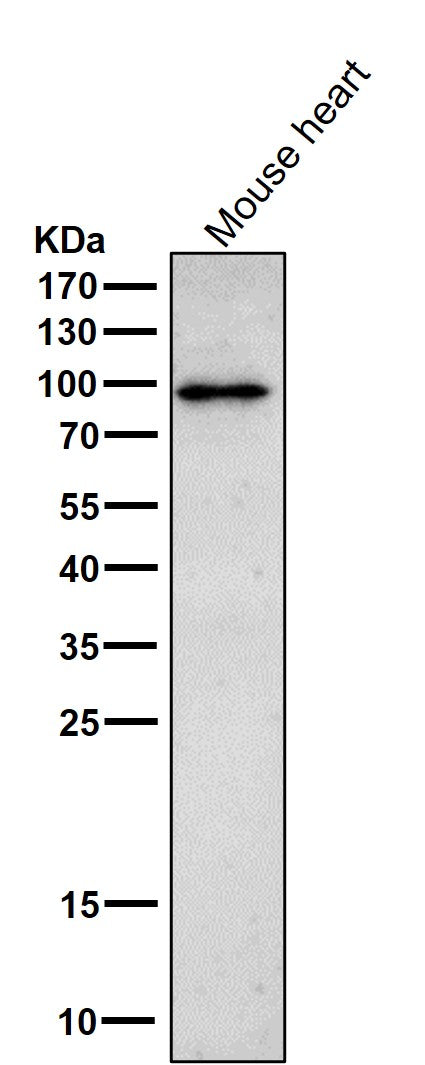 All lanes use the Antibody at 1:1K dilution for 1 hour at room temperature.
