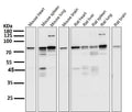 All lanes use the Antibody at 1:5K dilution for 1 hour at room temperature.