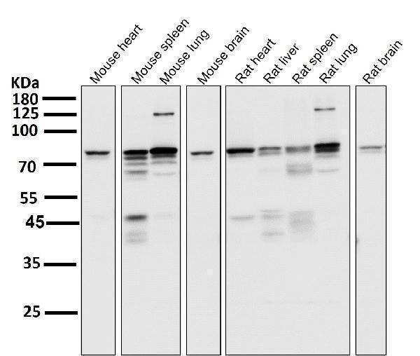 All lanes use the Antibody at 1:5K dilution for 1 hour at room temperature.