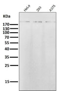 All lanes use the Antibody at 1:5K dilution for 1 hour at room temperature.