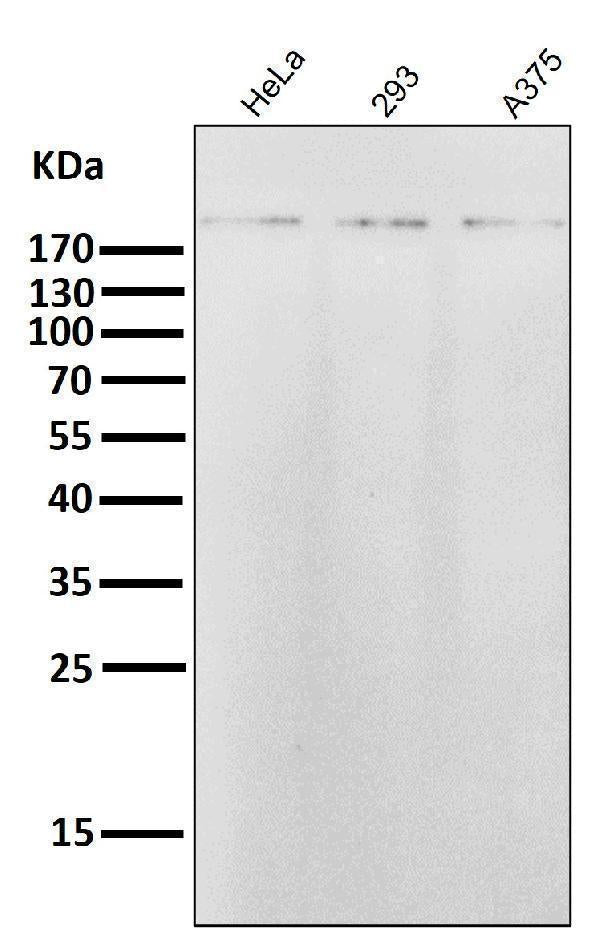 All lanes use the Antibody at 1:5K dilution for 1 hour at room temperature.
