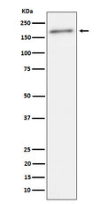 Western blot analysis of Phospho-ErbB2(Y1221 + Y1222) expression in SKBR3 cell lysate.