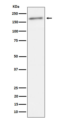 Western blot analysis of Phospho-ErbB2(Y1221 + Y1222) expression in SKBR3 cell lysate.