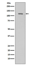 Western blot analysis of TERT expression in Hela cells lysate.