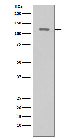 Western blot analysis of TERT expression in Hela cells lysate.