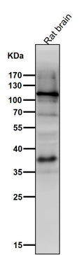 Anti-HIF-1 alpha Rabbit Monoclonal Antibody