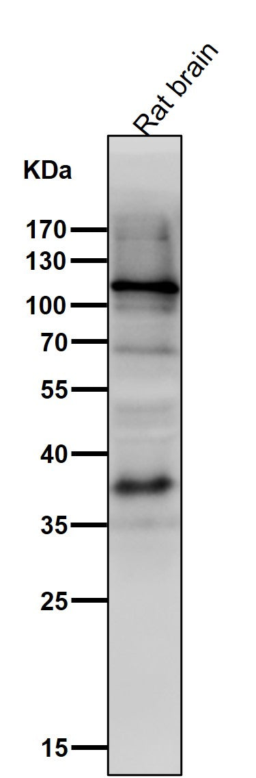 Anti-HIF-1 alpha Rabbit Monoclonal Antibody