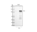 Anti-HIF-1-alpha Rabbit Monoclonal Antibody