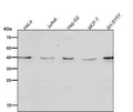 Anti-CTLA4 (CD152) Monoclonal Antibody