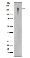 Western blot analysis of EGFR in A431 cell lysate.
