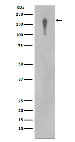 Western blot analysis of EGFR in A431 cell lysate.