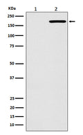 Western blot analysis of EGFR(L858R) expression in (1) HeLa cell lysate; (2) H1975 cell lysate.