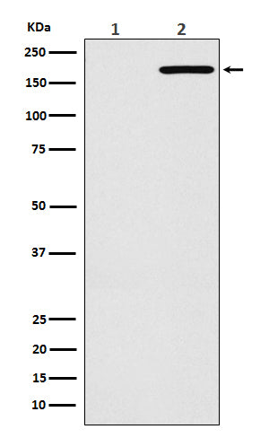 Western blot analysis of EGFR(L858R) expression in (1) HeLa cell lysate; (2) H1975 cell lysate.
