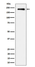 Western blot analysis of Phospho-EGFR (Y869) expression in A431 treated with EGF cell lysate.