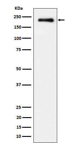 Western blot analysis of Phospho-EGFR (Y869) expression in A431 treated with EGF cell lysate.