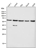All lanes use the Antibody at 1:1W dilution for 1 hour at room temperature.