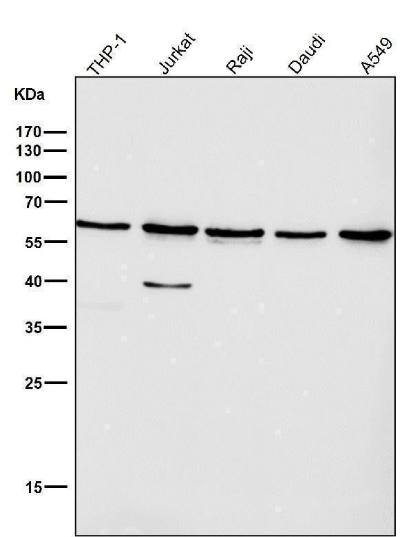 All lanes use the Antibody at 1:1W dilution for 1 hour at room temperature.