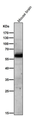 All lanes use the Antibody at 1:1W dilution for 1 hour at room temperature.