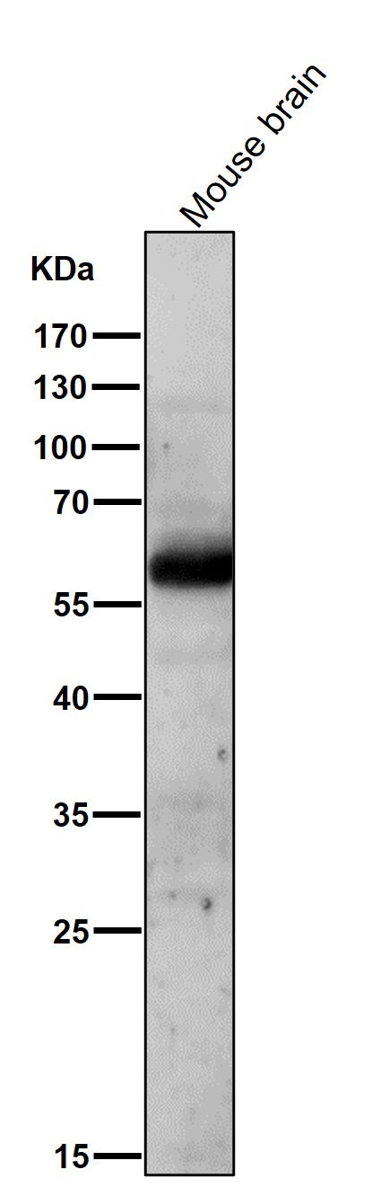 All lanes use the Antibody at 1:1W dilution for 1 hour at room temperature.