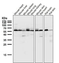 All lanes use the Antibody at 1:5K dilution for 1 hour at room temperature.
