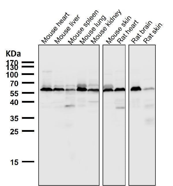 All lanes use the Antibody at 1:5K dilution for 1 hour at room temperature.