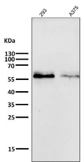 All lanes use the Antibody at 1:1W dilution for 1 hour at room temperature.