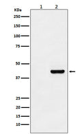 Western blot analysis of Myc-tagged protein expression in (1) 293T cell lysate; (2) 293T cell transfected with Myc-tagged protein lysate.