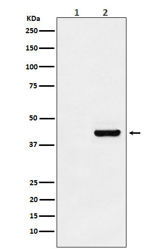 Western blot analysis of Myc-tagged protein expression in (1) 293T cell lysate; (2) 293T cell transfected with Myc-tagged protein lysate.