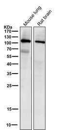 All lanes use the Antibody at 1:1K dilution for 1 hour at room temperature.