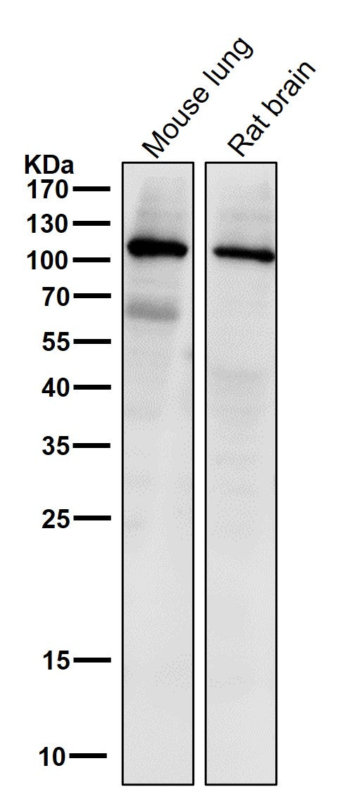 All lanes use the Antibody at 1:1K dilution for 1 hour at room temperature.