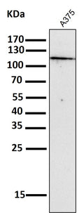 All lanes use the Antibody at 1:2K dilution for 1 hour at room temperature.