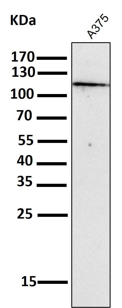 All lanes use the Antibody at 1:2K dilution for 1 hour at room temperature.